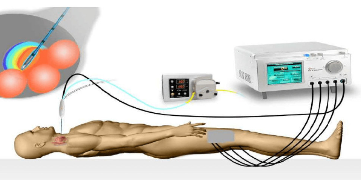 Unlocking Relief: Exploring the Benefits of Radiofrequency Ablation Devices for Pain Management
