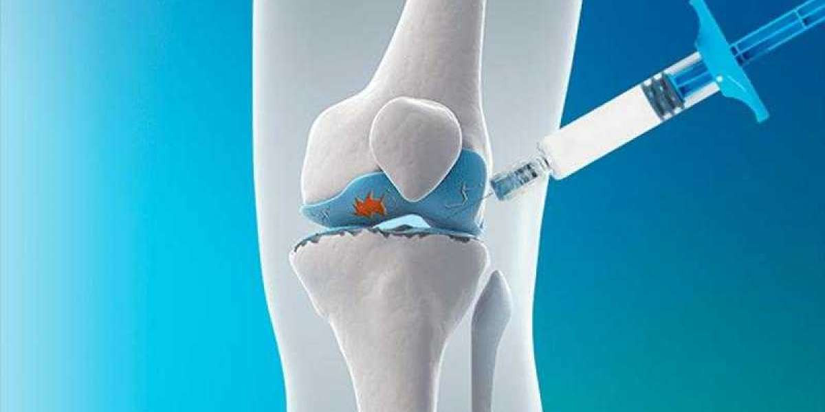 Viscosupplementation Is Usually Used When All Other Forms Of Pain Relief Have Failed