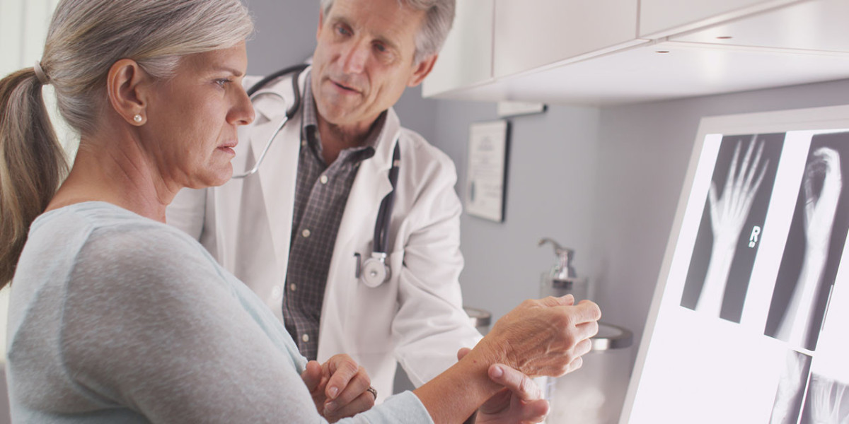 The Importance of Exercise in Preventing and Managing Postmenopausal Osteoporosis