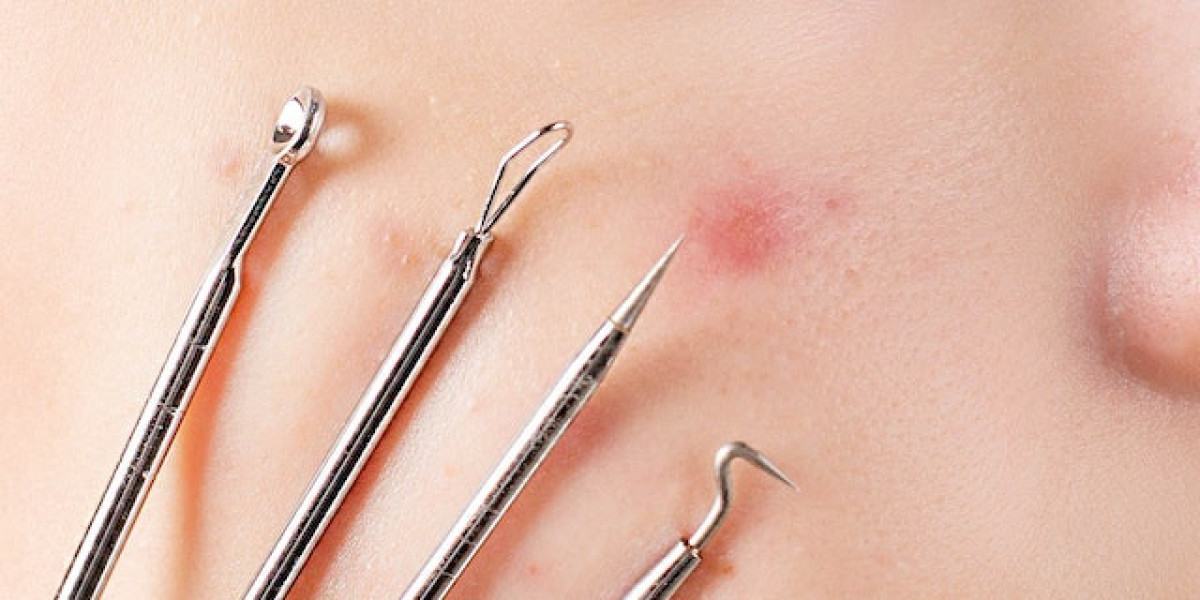 Aviclear Laser Treatment FAQs