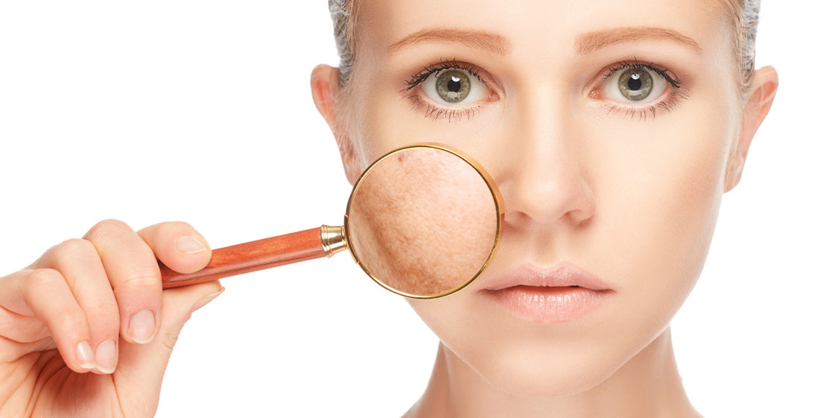 Melanin Matters: Promising Breakthroughs in Pigmentation Disorders Treatment