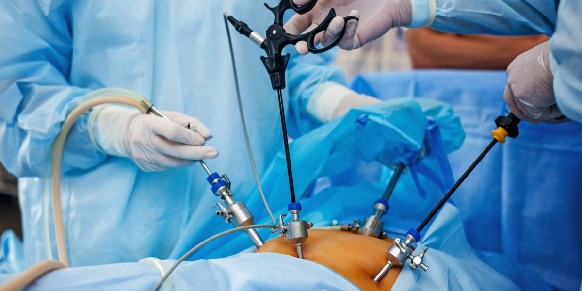 Bariatric Surgery Devices: Paving The Way For Long-Term Weight Maintenance