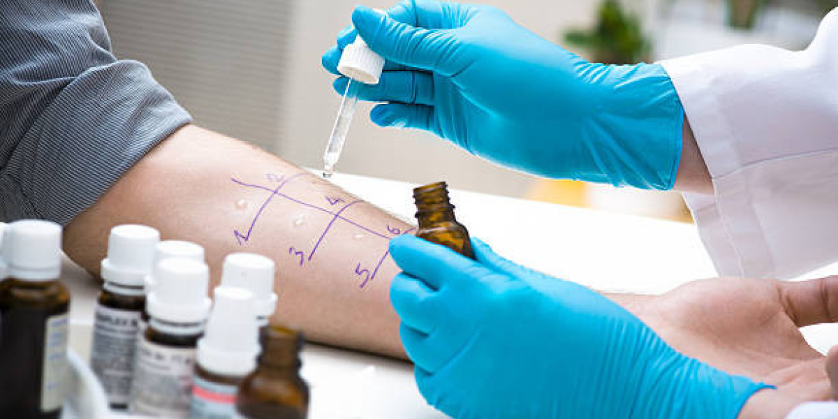 Allergy Treatment: How to Identify and Avoid Common Allergens