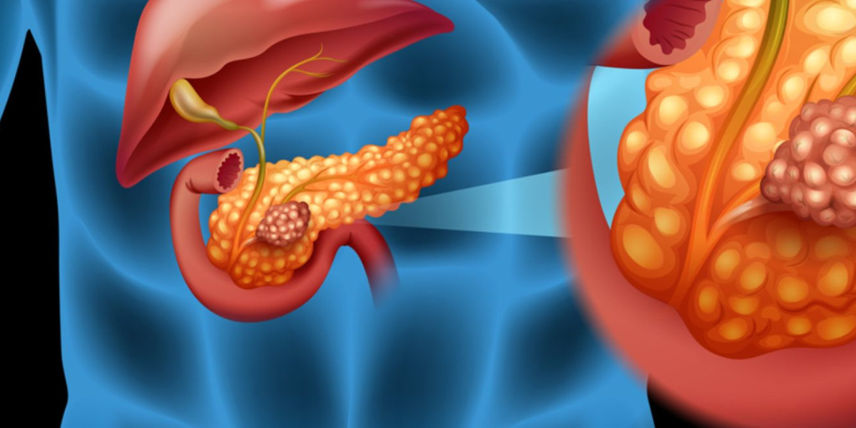 Pancreatic Cancer Market: Epidemiology, Trends, Demand, Share, Size (2023-2033)
