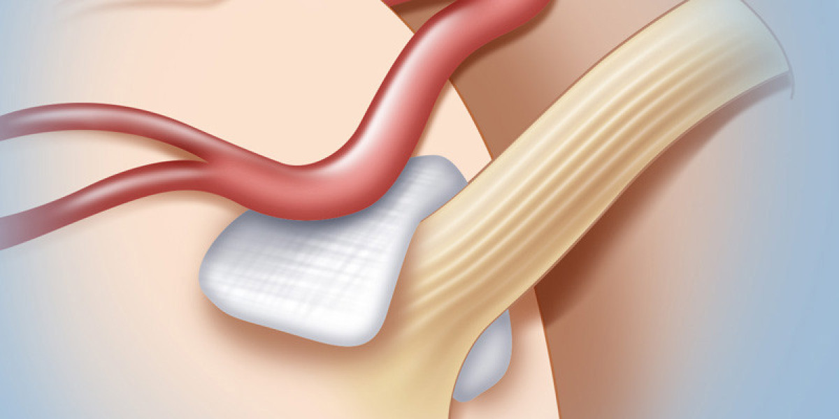Trigeminal Neuralgia Treatment Market Based on Comprehensive Future Insights and Technological Advancement