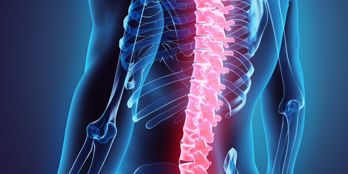 Transforming Spinal Care with Non-Fusion Devices: A Breakthrough in Treatment