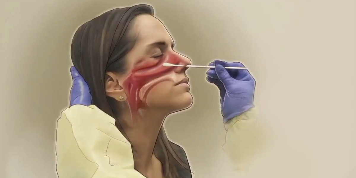 A Comprehensive Guide to Nasopharyngeal Carcinoma Treatment: Strategies and Options