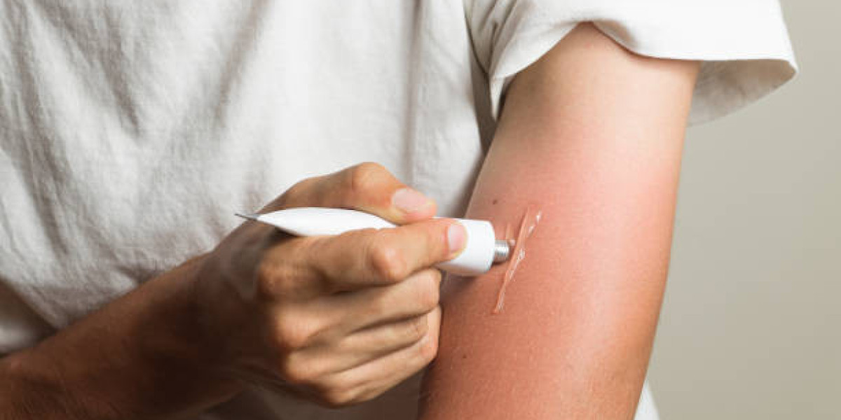 Burn Ointment Market Top Regions and Latest Growing Factors Forecast 2027