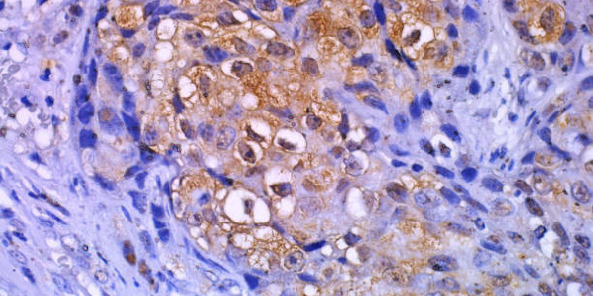 Precision Diagnostics: Harnessing Immunohistochemistry for Accurate Tissue Analysis