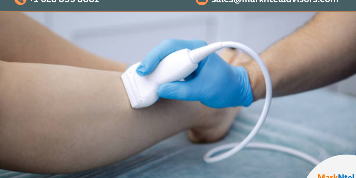 THERAPEUTIC ULTRASOUND Market Insights: Top Companies, Regional Analysis, and Growth Opportunities