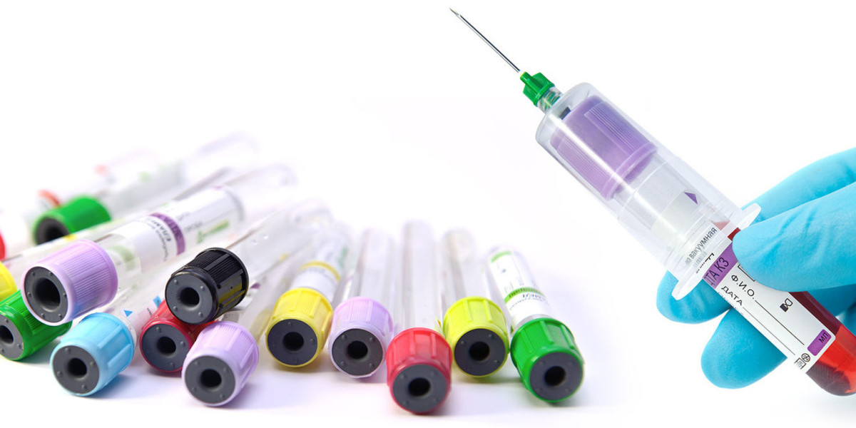 Vacuum Blood Collection System: Addressing Sample Clotting Issues   