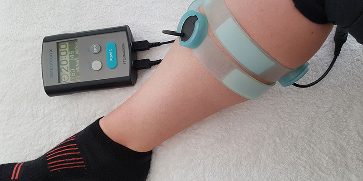 Managing Osteoporosis with Bone Growth Stimulators: A Promising Approach