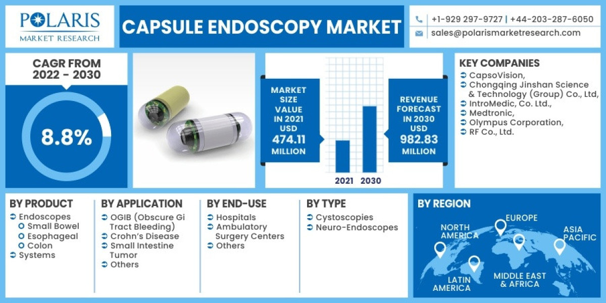 Global Capsule Endoscopy Market Analysis Report – Huge Growth, Application And Opportunities By 2032
