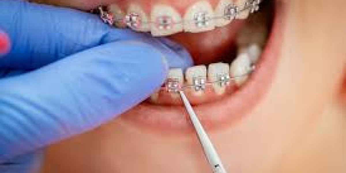 Orthodontist Farmington CT
