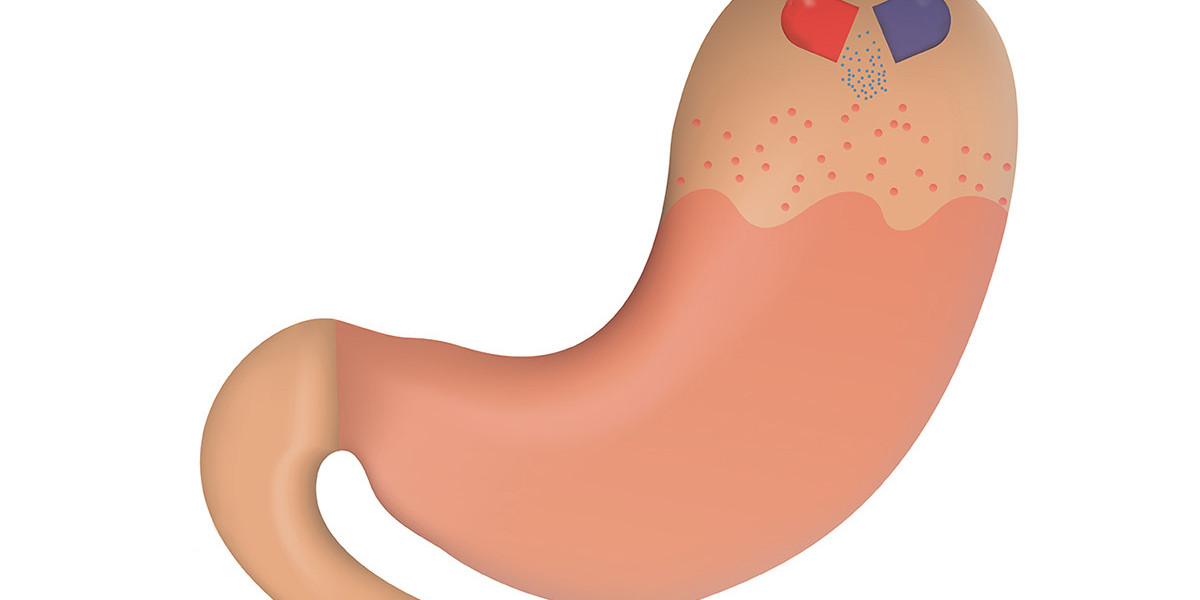 The Impact Of Proton Pump Inhibitors On Gastric Acid Secretion