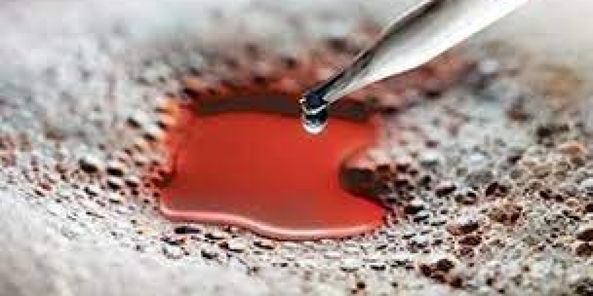 Silicone Additives Market Growth and Competitive Landscape till 2029