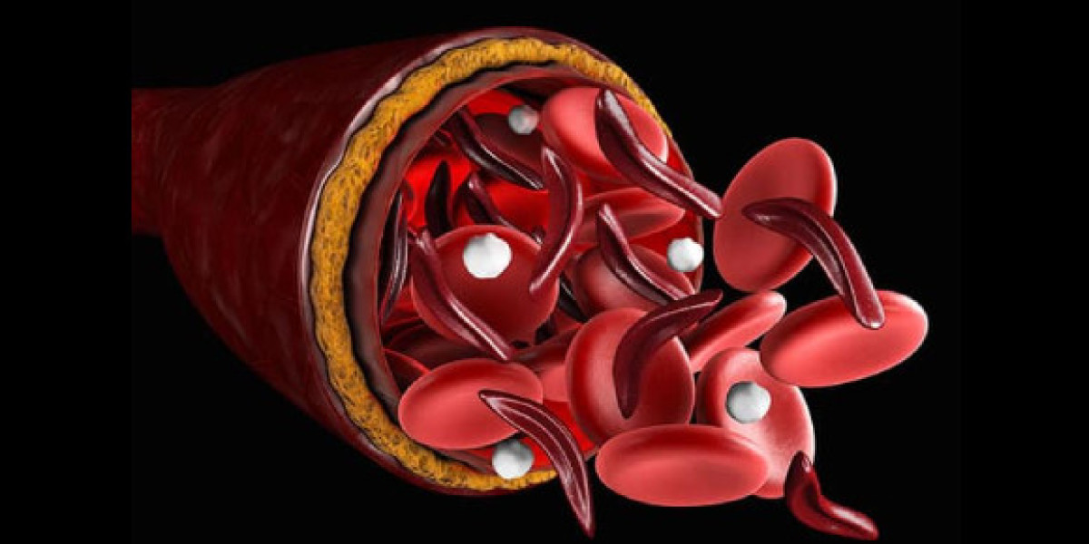 Immunohematology Market 2023 Share, Size, Growth, Trends and Forecast 2028
