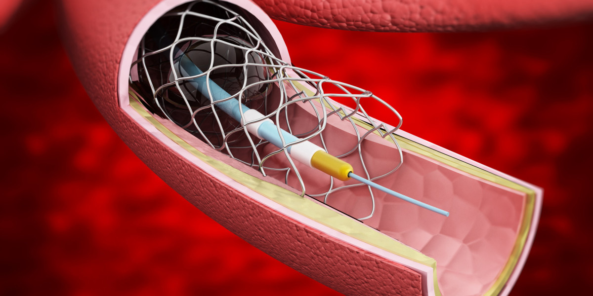 Enhancing Quality of Life with Peripheral Vascular Devices: Success Stories and Breakthroughs