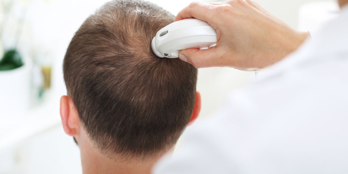 The Ultimate Guide To Effective Scalp Care: Unlock The Secrets To Healthy Hair