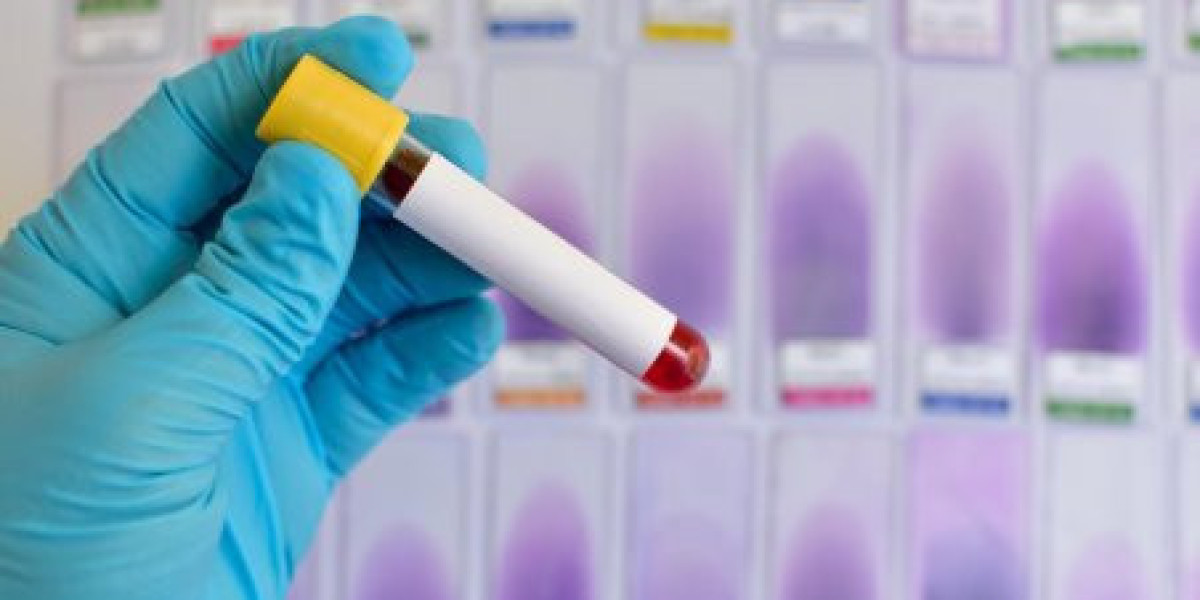 Bleeding Disorders Treatment Market 2022 Swot Analysis by Top Key Vendors, Demand And Forecast Research to 2030