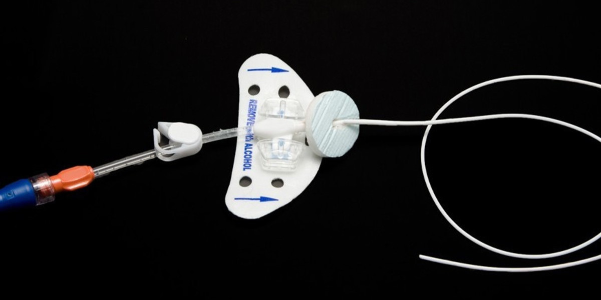 The Role of Nurses in Indwelling Catheter Management