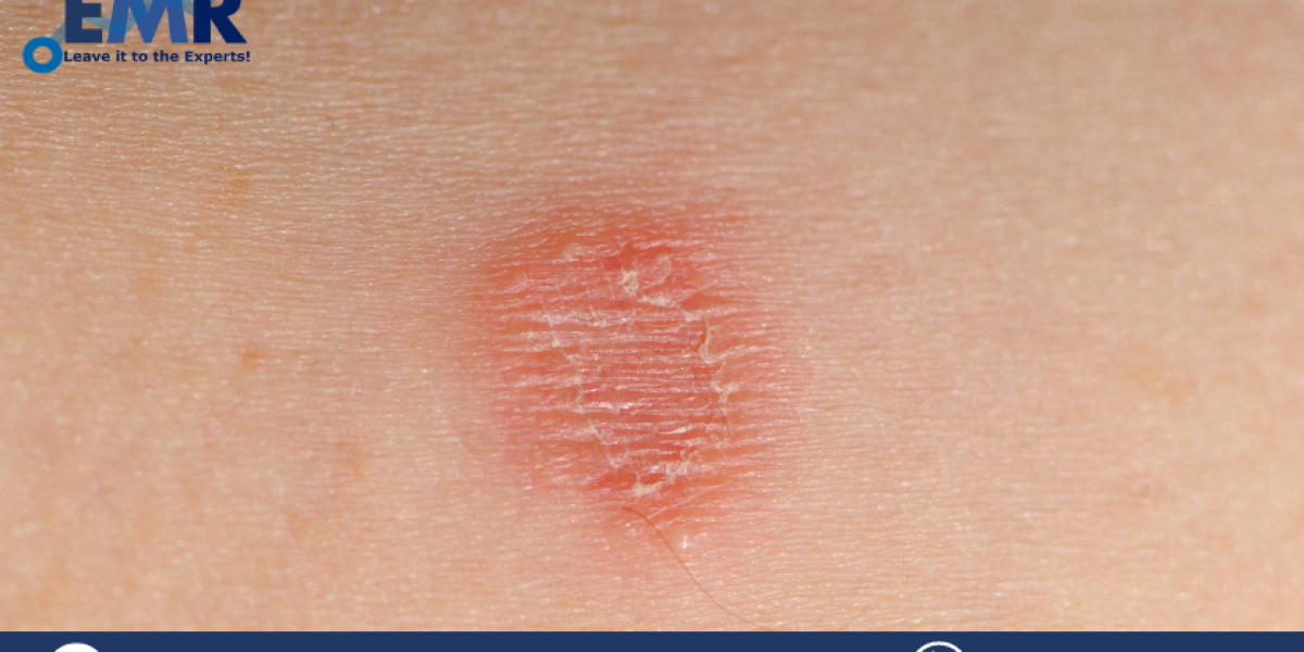 Global Tinea Corporis Treatment Market Size, Share, Price, Trends, Growth, Report And Forecast 2023-2028