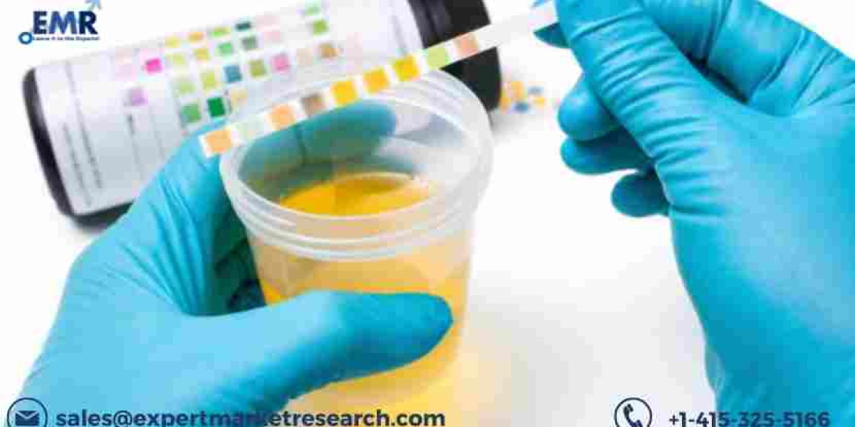 Urinalysis Market Size, Share, Growth, Industry Outlook 2028