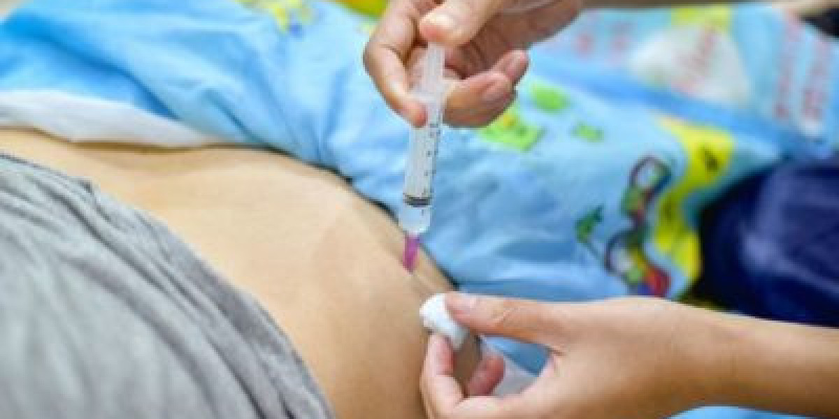 Wound Closure Industry Demand ,Growth Factors,Future Trends,Outlook 2023