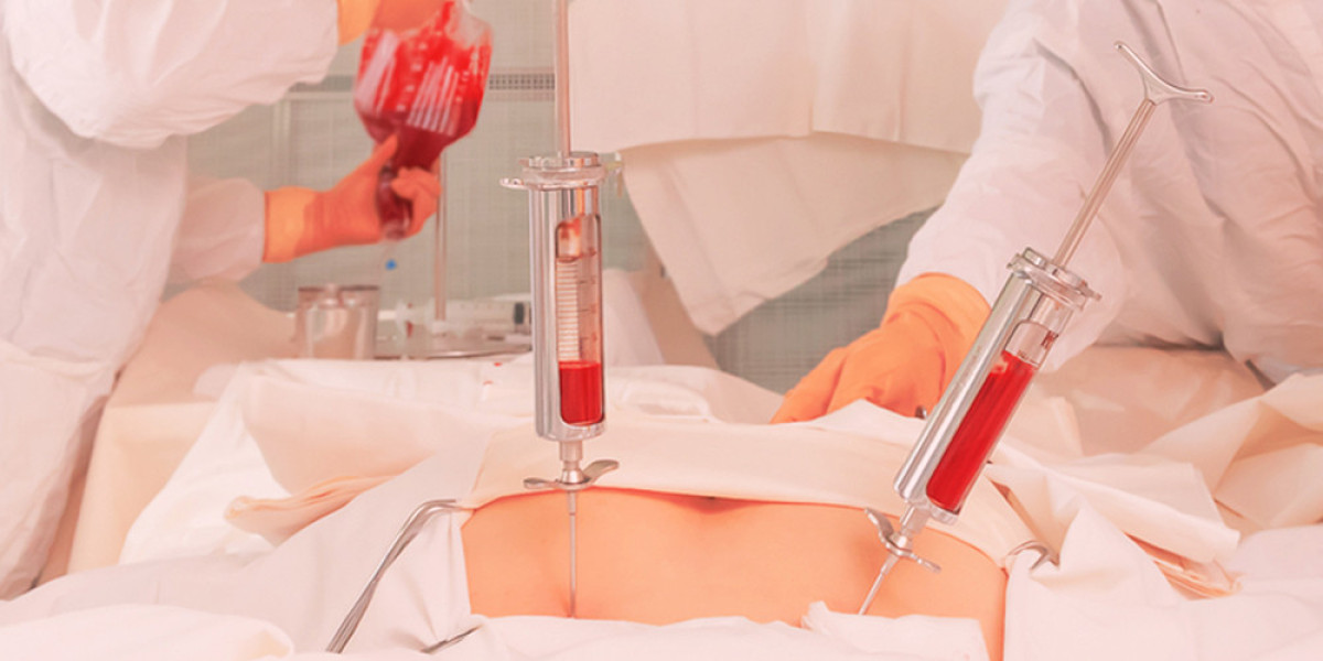 Rebuilding Lives: The Transformative Impact Of Bone Marrow Transplant