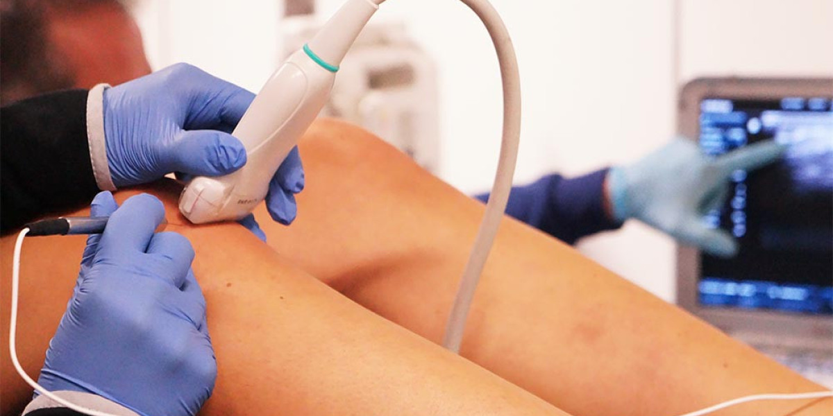 Exploring Viscosupplementation: How Hyaluronic Acid Injections Can Improve Joint Health