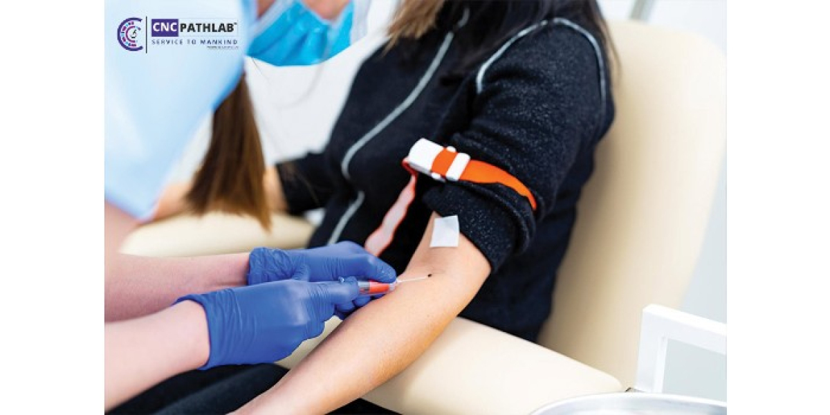 How Blood Test Home Collection Enables Personalized Health Monitoring