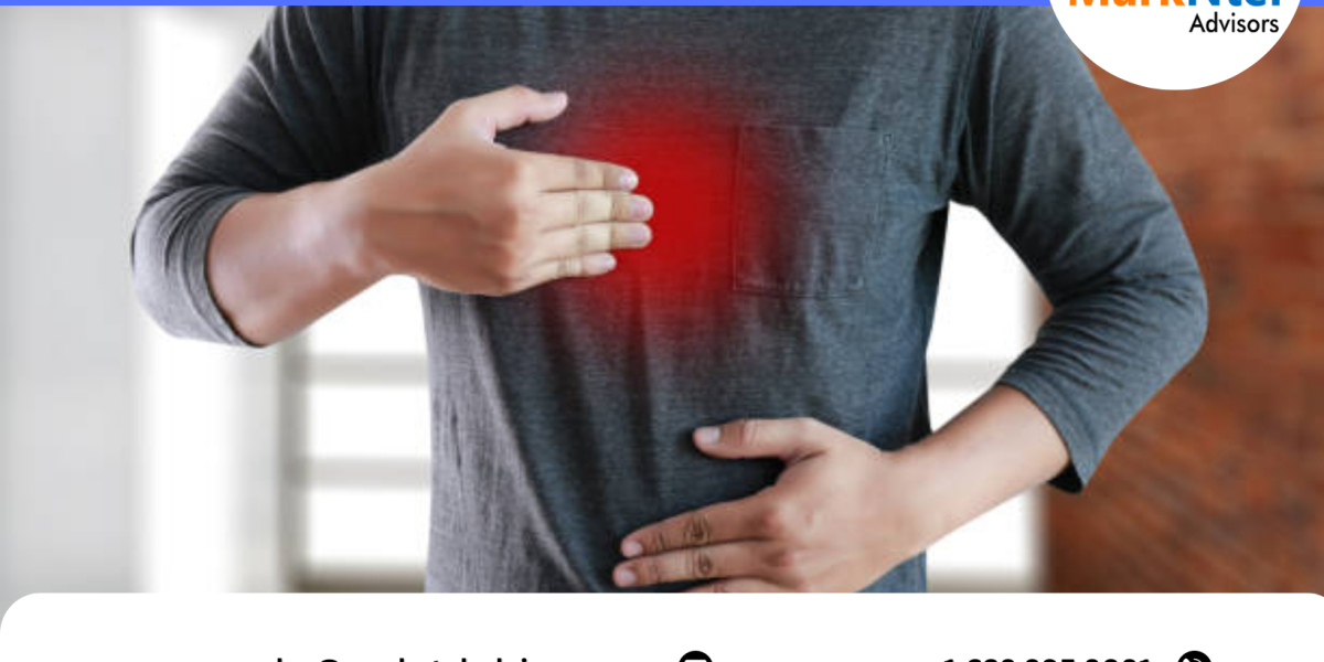 Gastroesophageal Reflux Disease Device Market Growth: Size, Share, and Future Scope