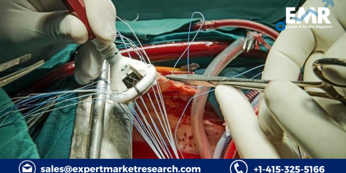 Aortic Valve Replacement Market Size, Share, Price, Report and Forecast 2023-2028