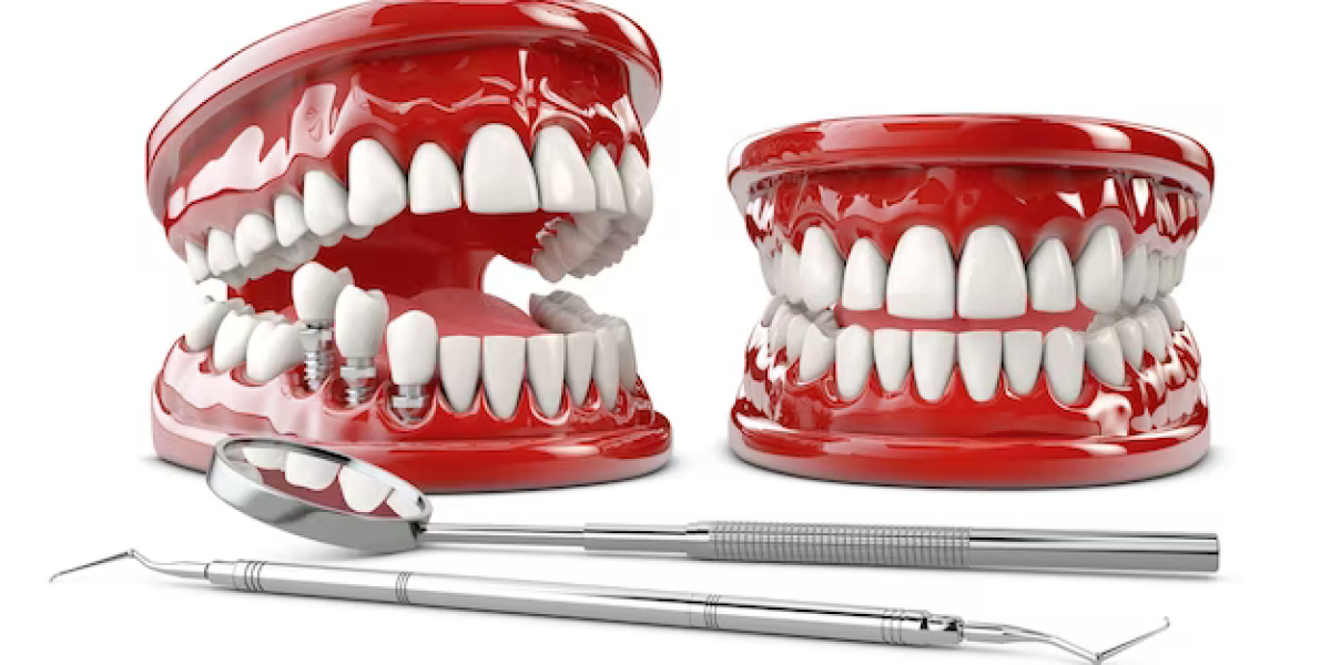 Dentures in Lafayette, LA: Restoring Smiles with Confidence