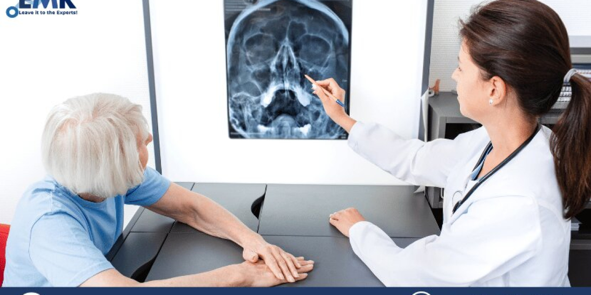 Sinusitis Treatment Market Size, Share, Growth, Industry, Report and Forecast 2023-2031