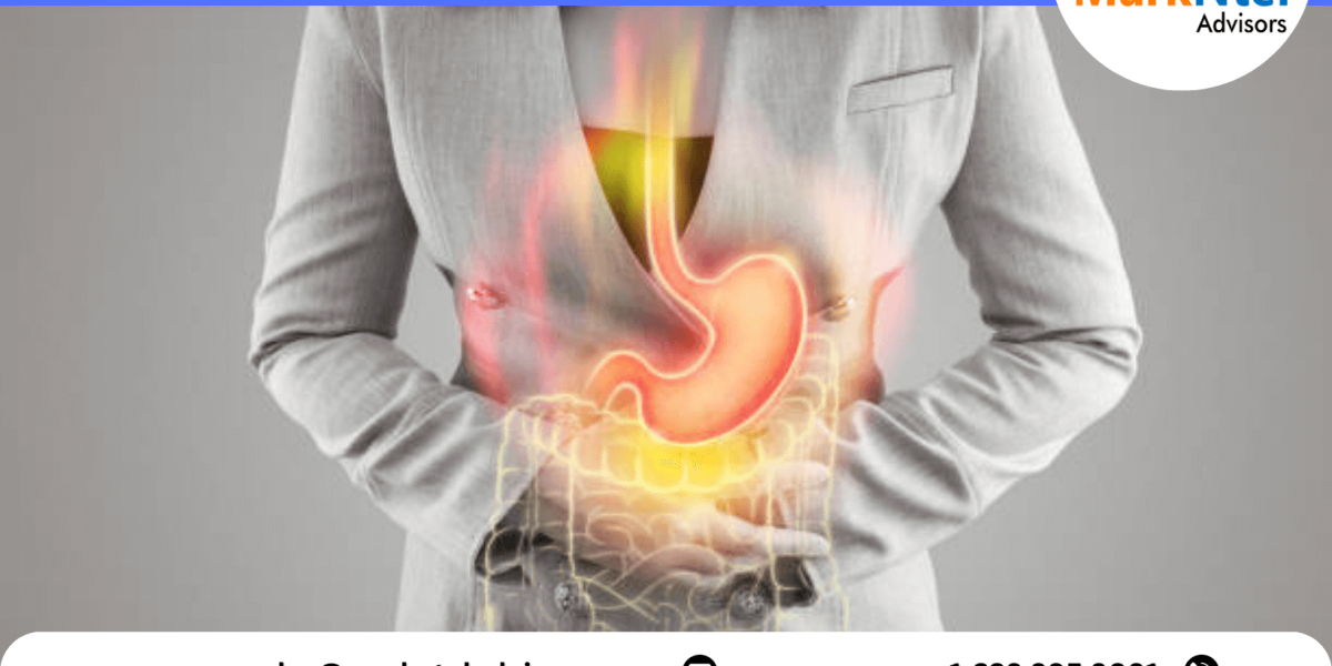 Gastroesophageal Reflux Disease Device Market Research 2021-2026: Growth Trends and Outlook Analysis