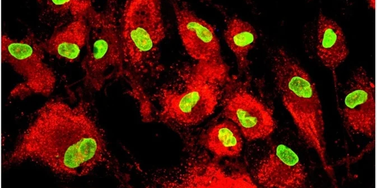 Mesenchymal Stem Cells Market 2023 | Industry Size and Forecast 2028