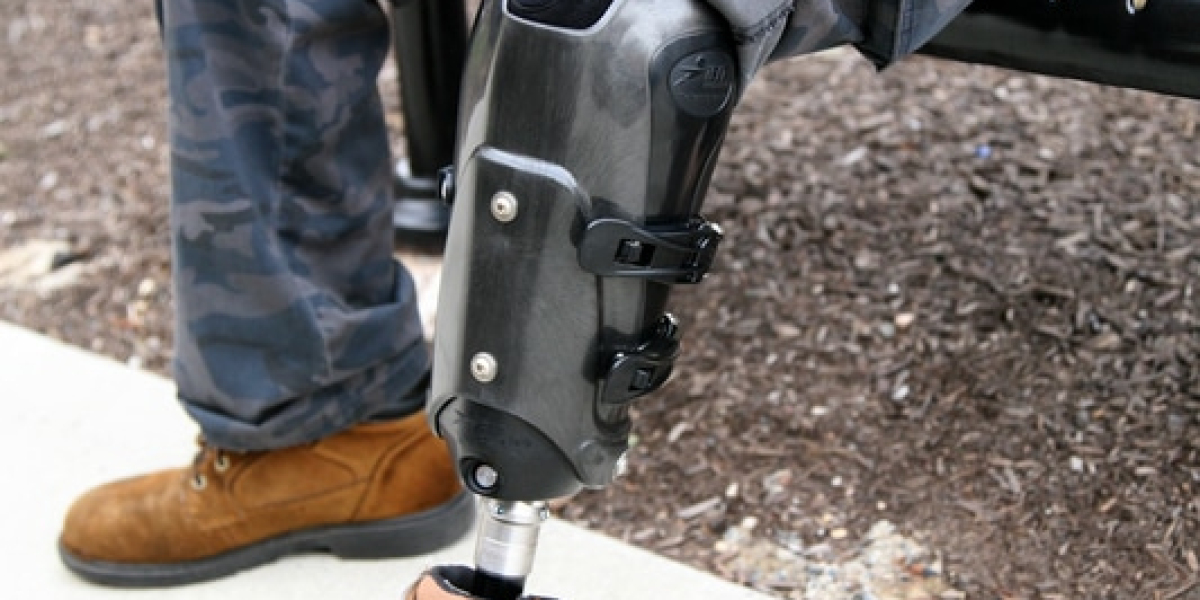 Revolutionizing Prosthetics with IFIT Prosthetics: Enhancing Mobility and Comfort