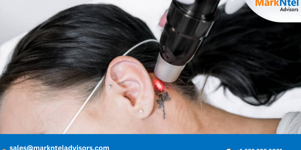 Tattoo Removal Laser Market Growth: Size, Share, and Future Scope