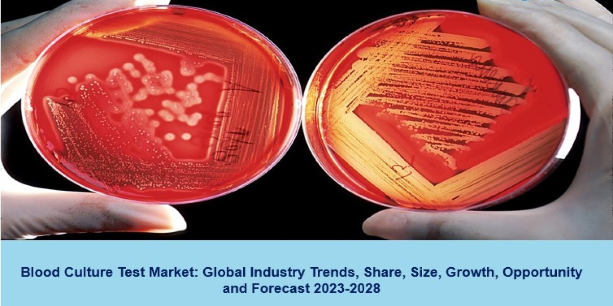 Blood Culture Test Market 2023 | Growth Opportunities, Trends, Size & Forecast 2028