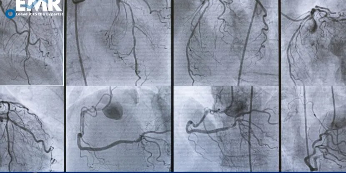 Acute Coronary Syndrome Treatment Market Size to Be Aided by the Rising Prevalence of Cardiovascular Diseases Report 202