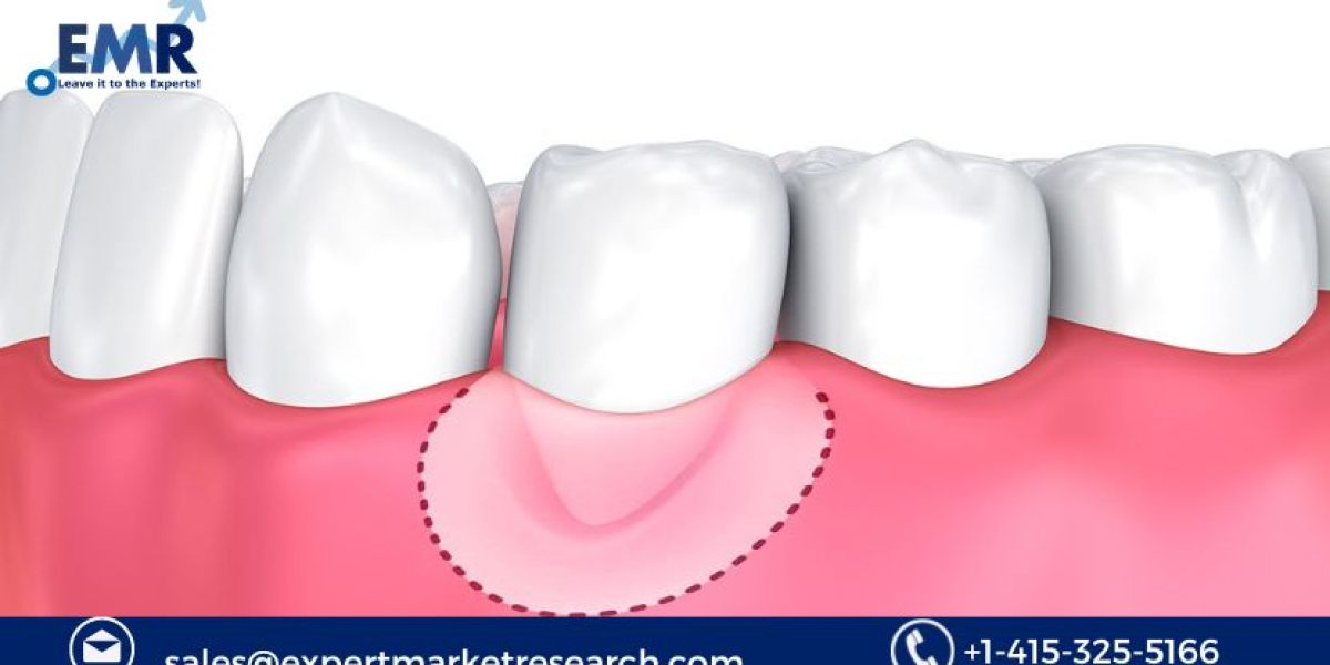 Soft Tissue Allografts Market to be Driven by the Increase in the Frequency of Orthopedic Surgeries and Dental Implants 