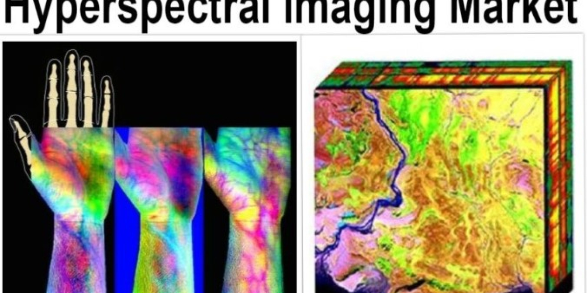U.S. Medical Hyperspectral Imaging Market Segmentation, Opportunities, Forecast to 2030