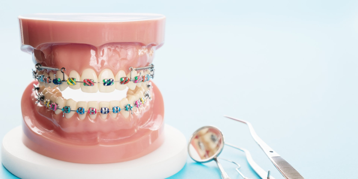 Global Orthodontic Supplies Market Size, Share, Trend, Forecast 2022 – 2032.
