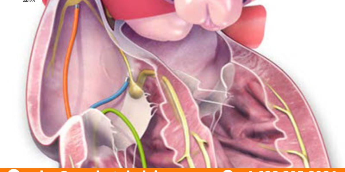 The Business of Global Electrophysiology Market: Investment Opportunities and Challenges