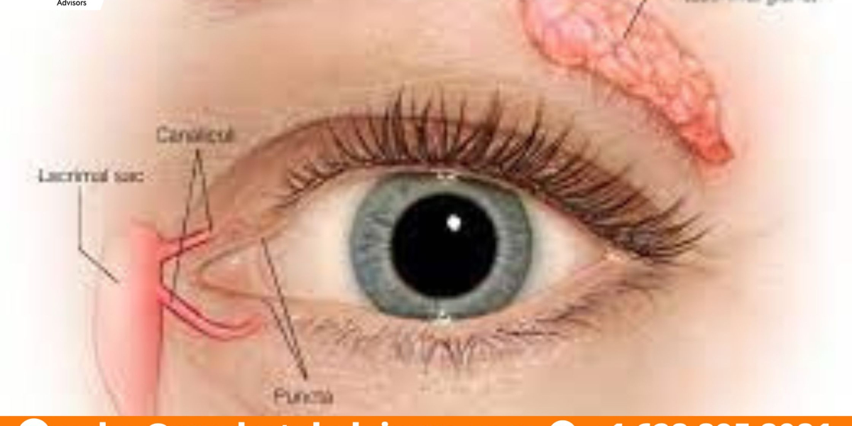 The Business of Global Dry Eye Syndrome Market: Investment Opportunities and Challenges