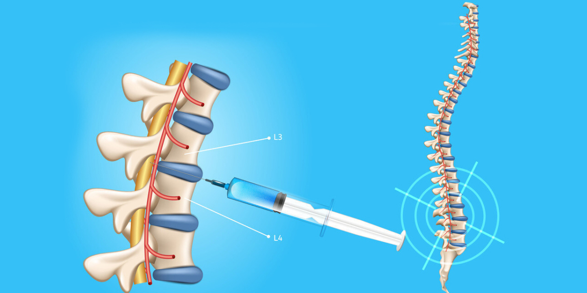 Spinal Needles Market Share to Cross USD 0.44 Billion Valuation by 2030