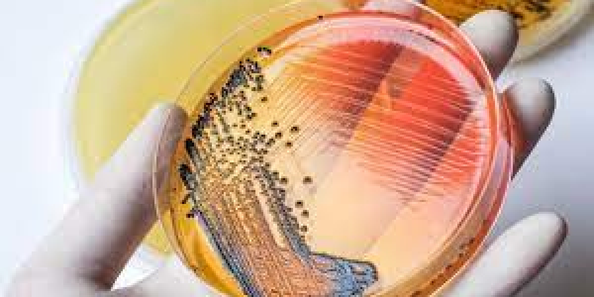 Enteric Disease Testing Market 2023 Industry Development, Analysis of Driving Factors and Growth Forecast to 2030
