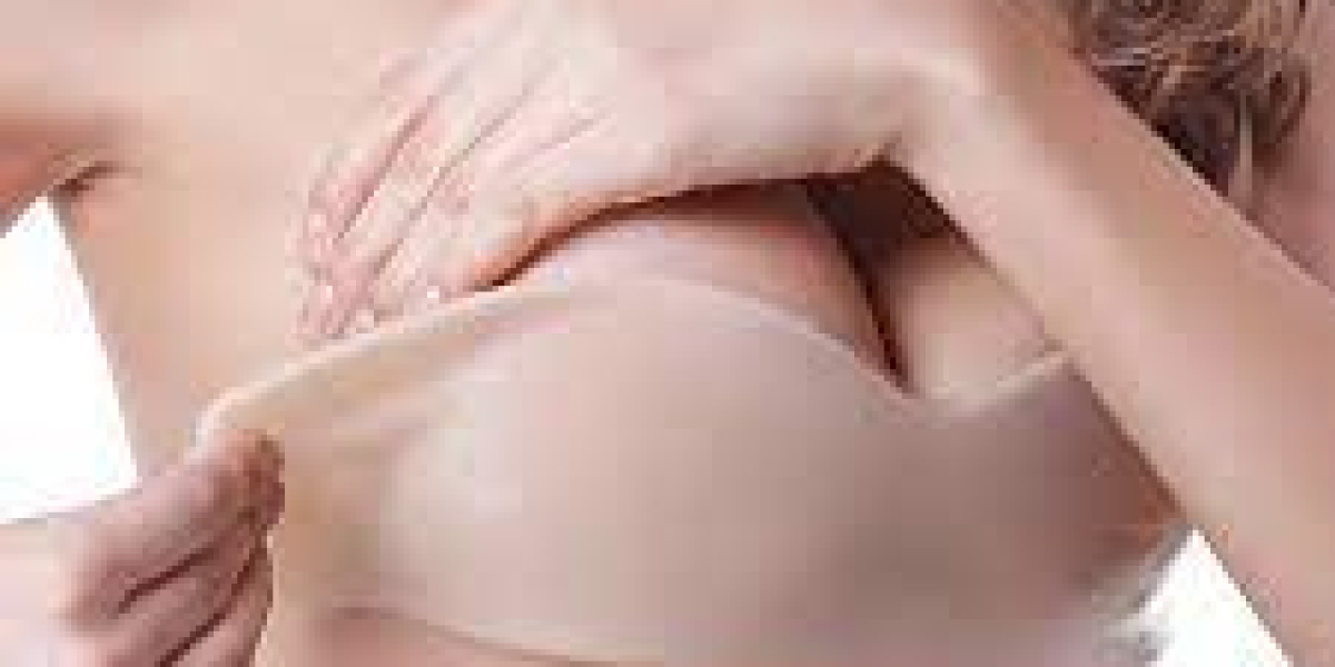 United States Silicone Bra Market Size 2017: Segment Overview, Company Profiles, Regional Analysis and Forecast 2027