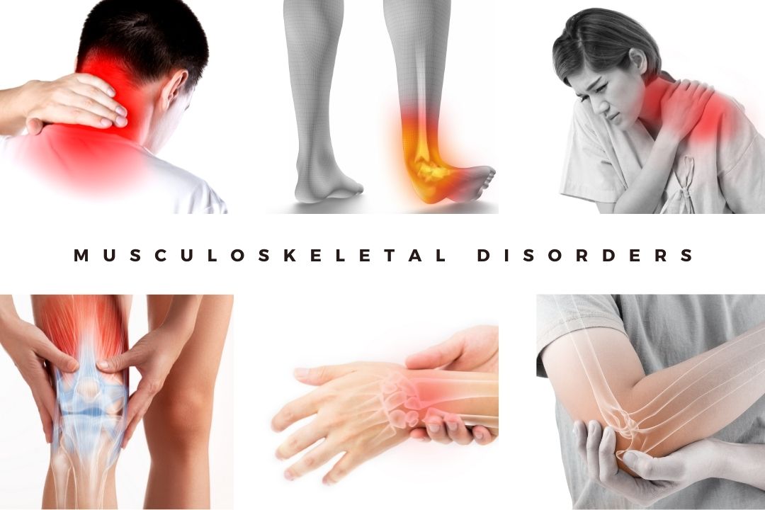 Know the Types of Musculoskeletal Disorders and How to Avoid Them